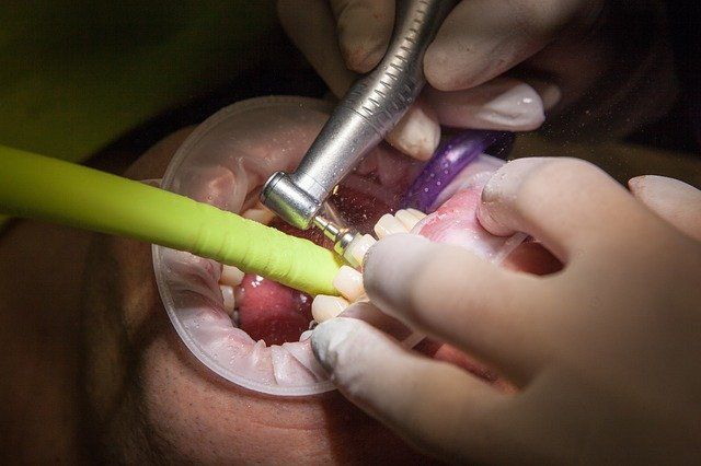Clínica Dental García Agúndez con tratamiento de periodoncia 