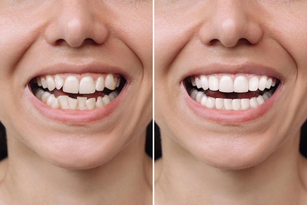 dentista caceres img 13